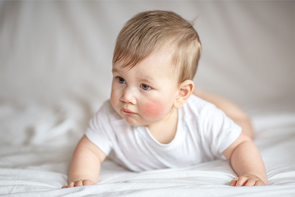 Neurodermitis bei Babys: Ursachen, Symptome & Hilfe
